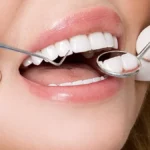 Стоматологическая клиника Дантист, лечение и протезирование зубов